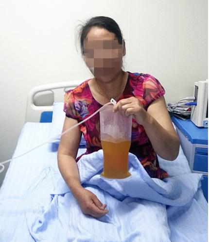 解析甘油三酯与总胆红素升高，健康警钟的双重奏